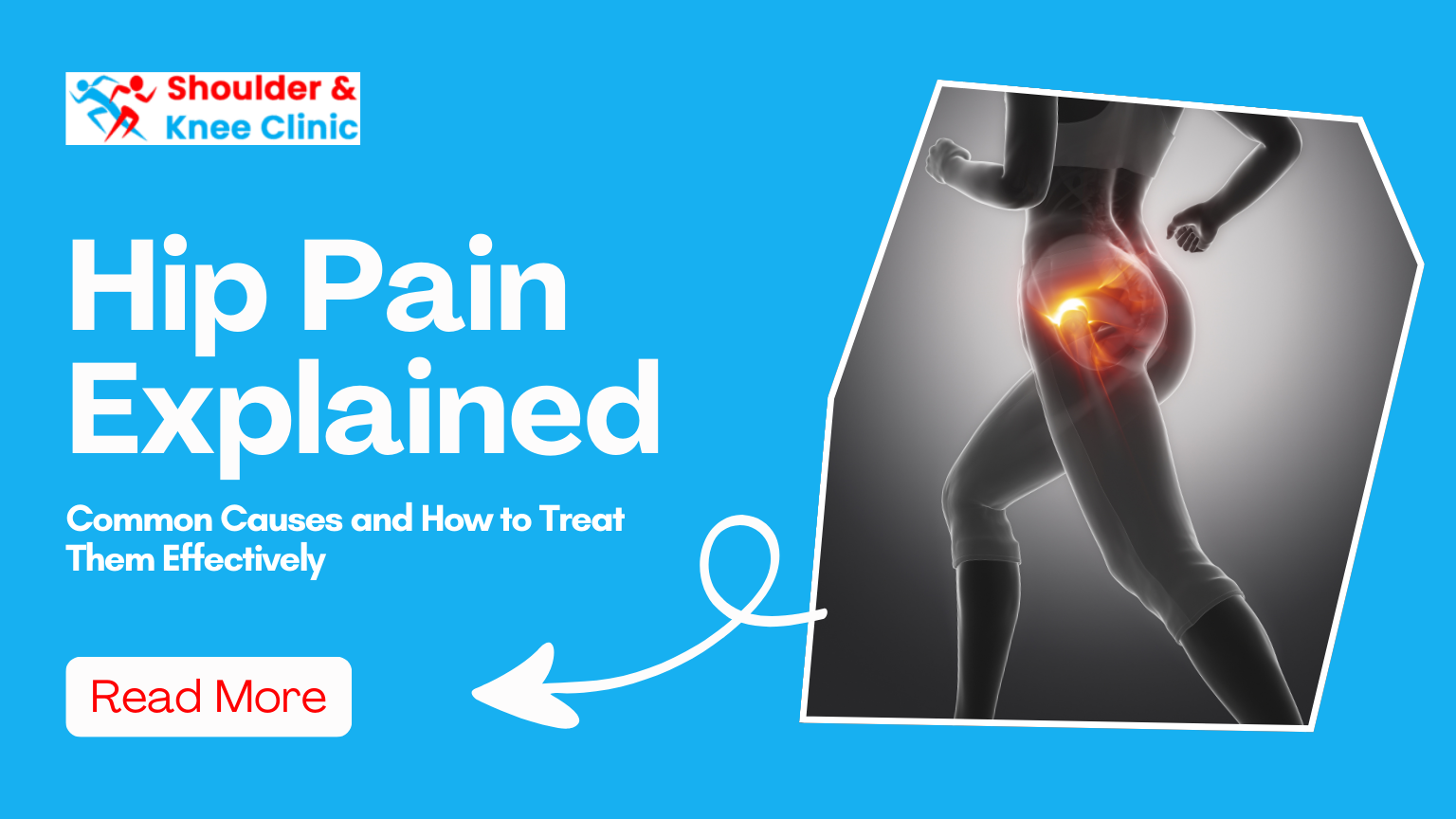 Hip Pain Explained