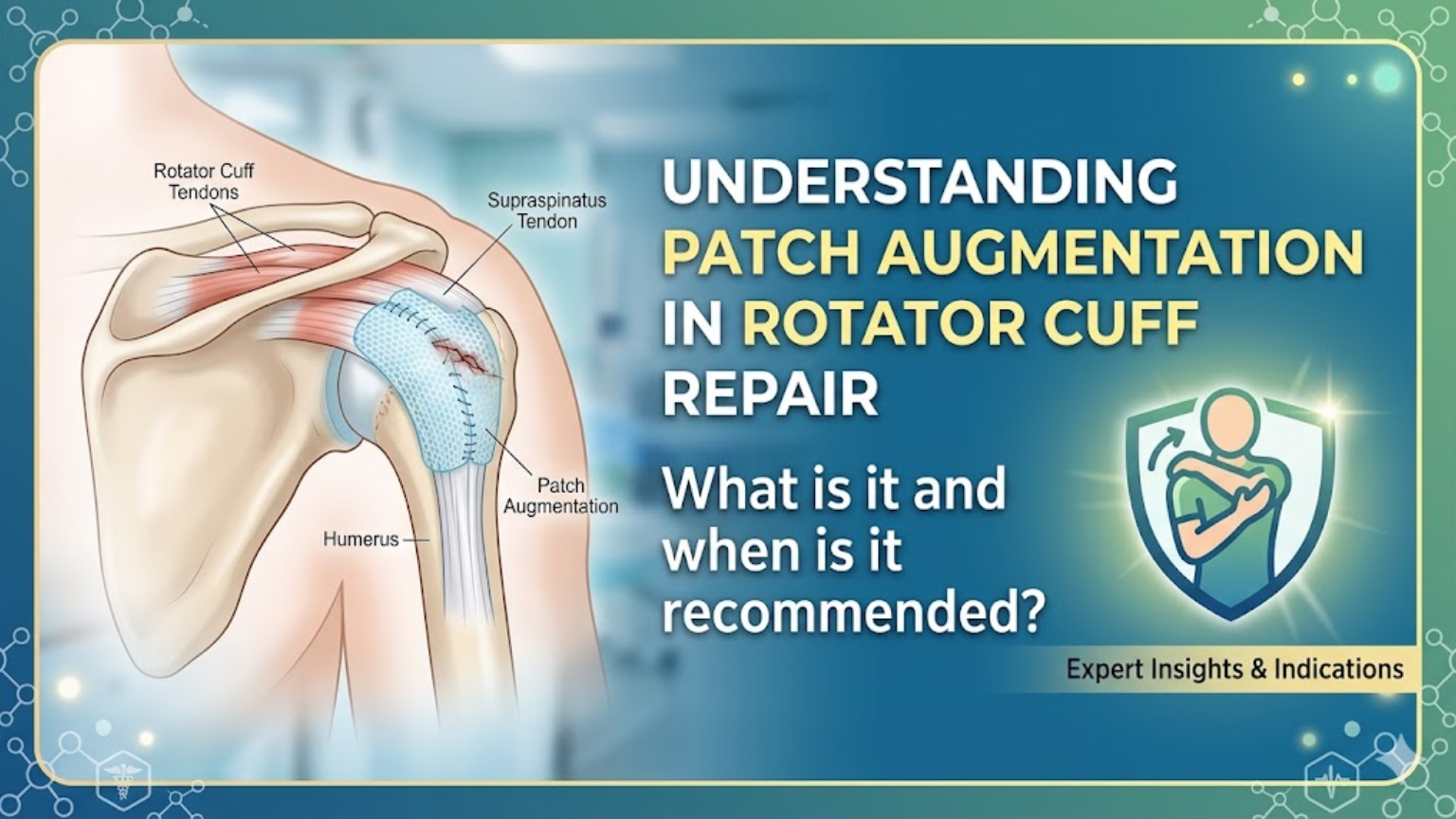 What Is Patch Augmentation in Rotator Cuff Repair