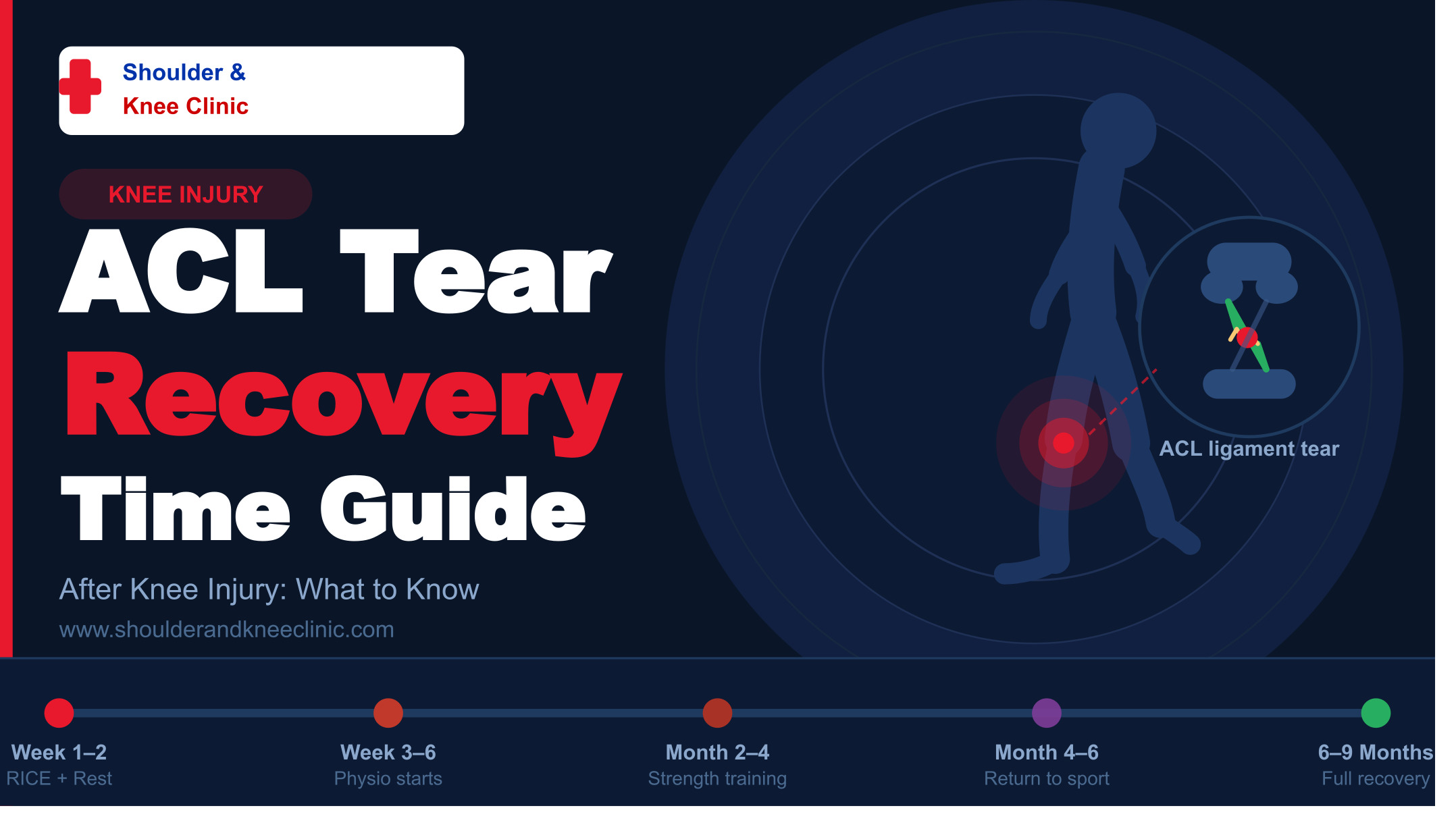 ACL Tear Recovery Time After Knee Injury