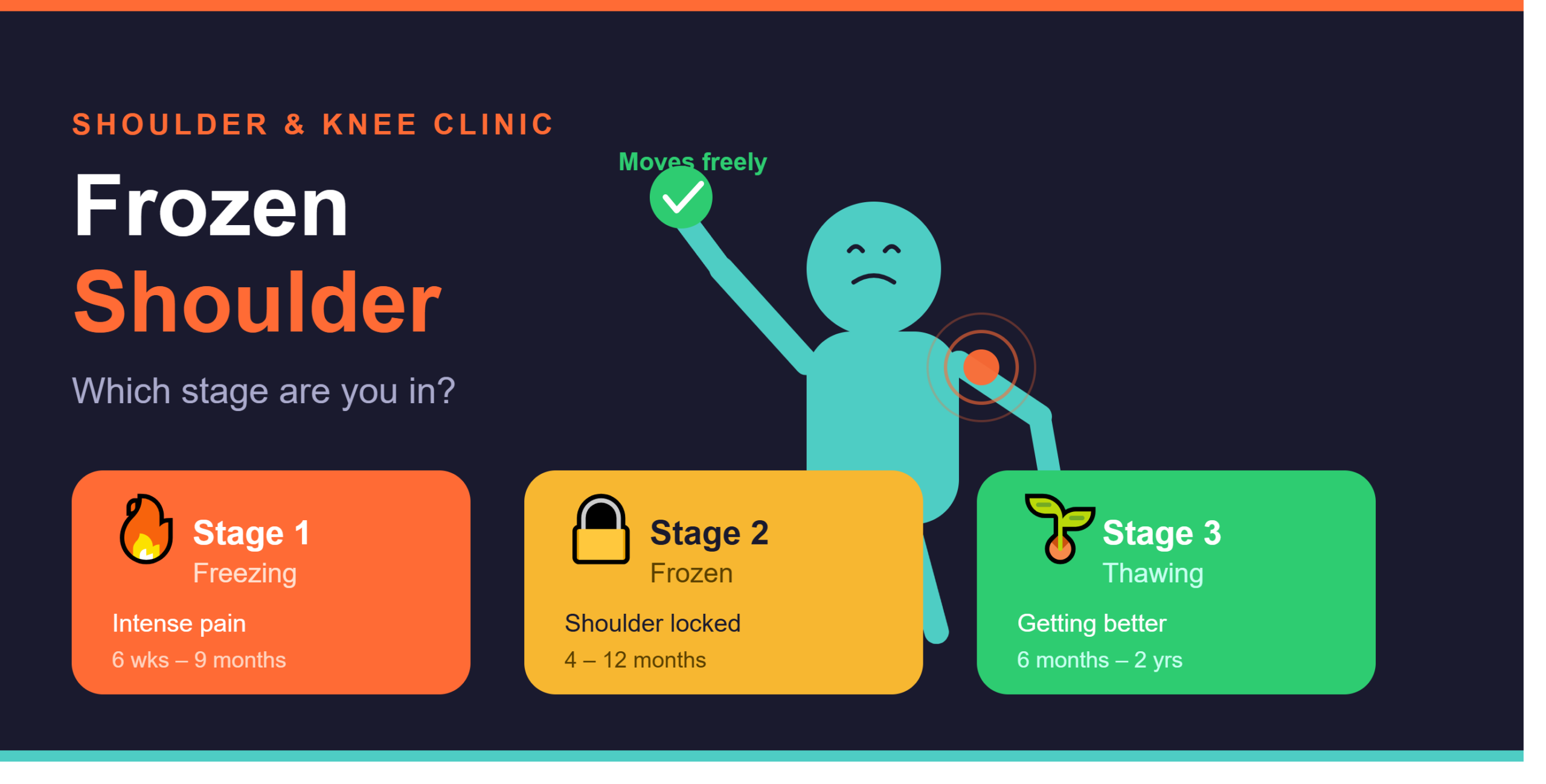 Frozen Shoulder Stages: Which Stage Are You In?